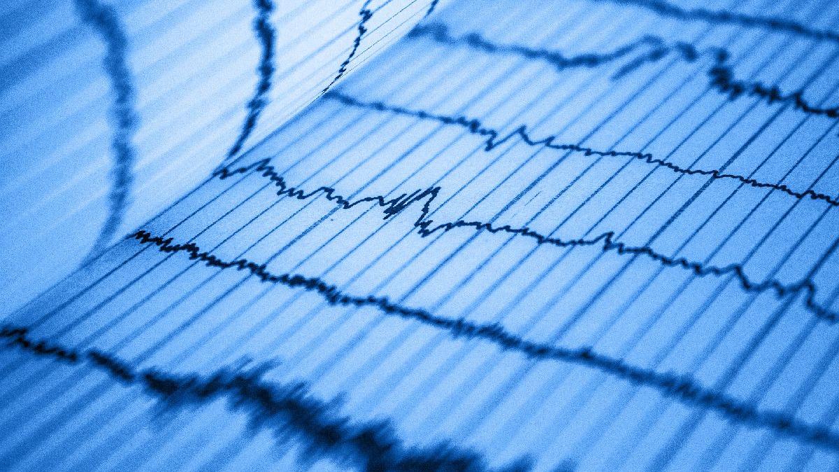 Cei cu fibrilaţie permanentă se tratează zilnic cu anticoagulante