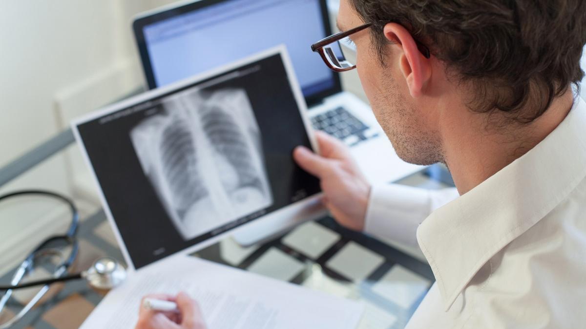 4 din 10 pacienți cu COVID rămân cu sechele pulmonare