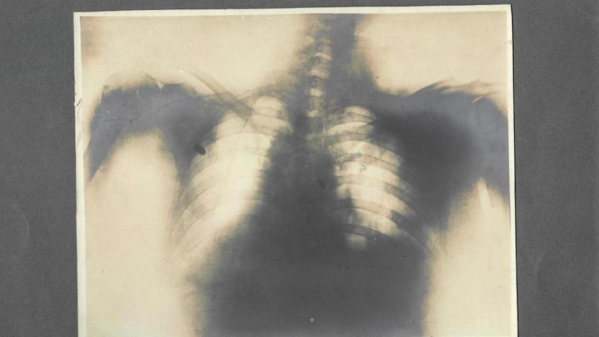 Radiografia lui Brătianu va fi expusă după 112 ani de la atentat 
