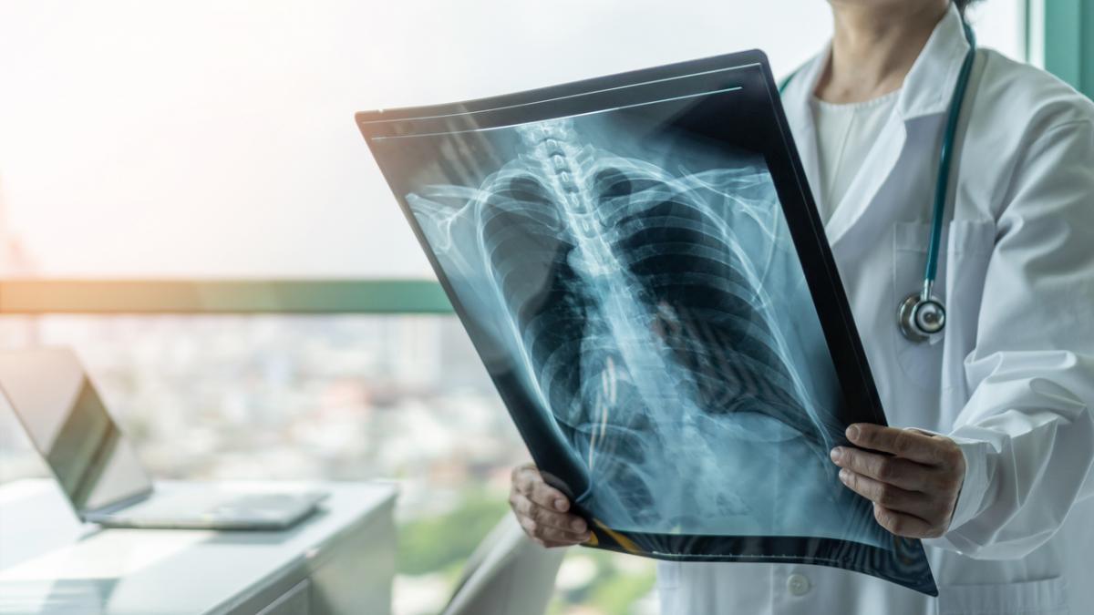 România, campioană la TBC. Cum vrea Guvernul să scape de tuberculoză până în 2035