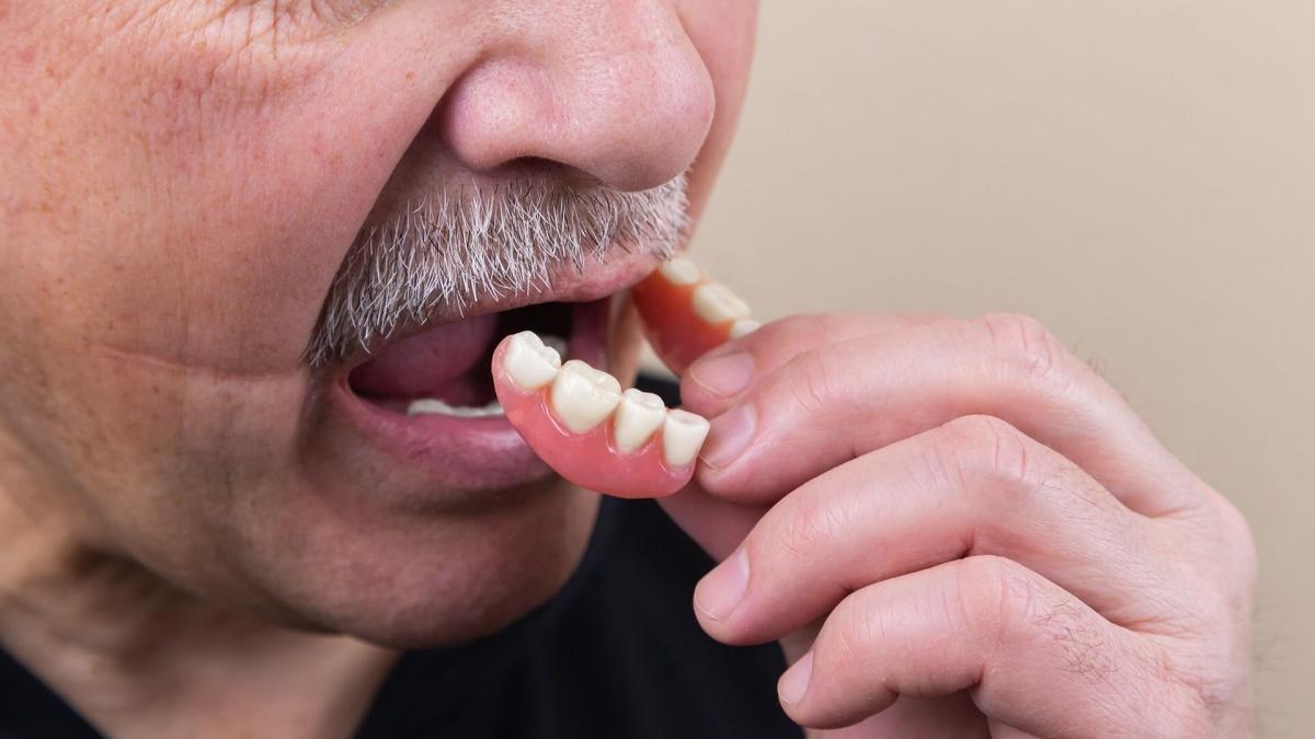 Implant dentar pentru persoanele de vârsta a treia