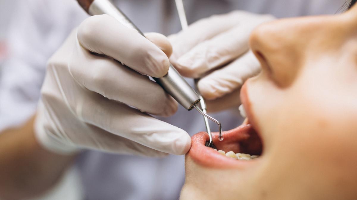 Implanturile dentare: cum funcționează și care sunt avantajele lor
