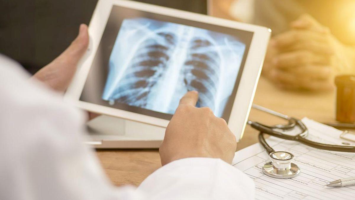 Ziua Mondială de Luptă împotriva Tuberculozei. 30.000 de bolnavi, în România