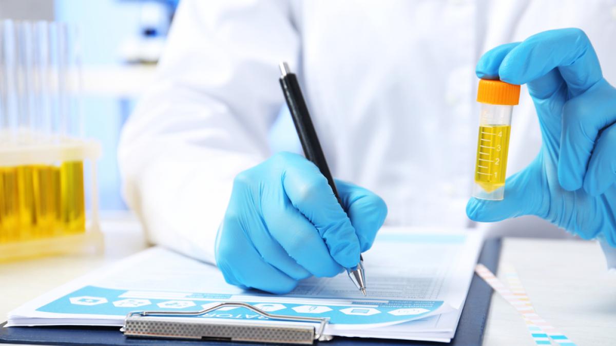 3 analize pe care trebuie să le faci dacă te expui la nichel