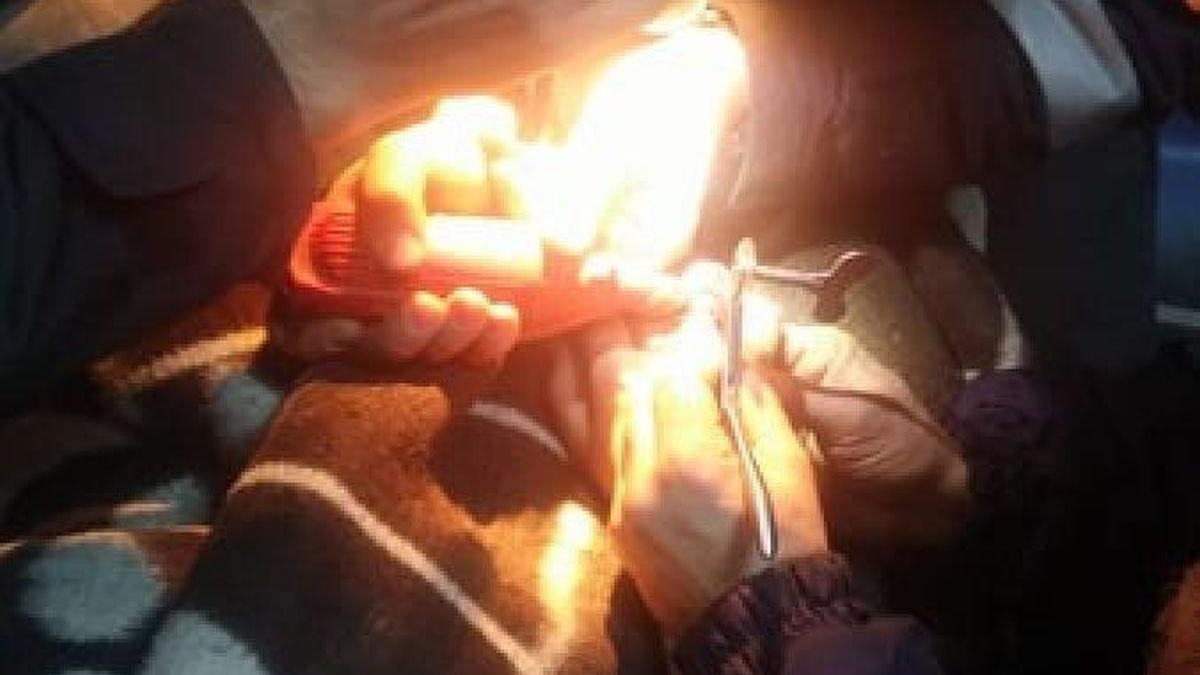 Pompierii, chemați să taie inelul de pe degetul umflat al unui băiat de 14 ani