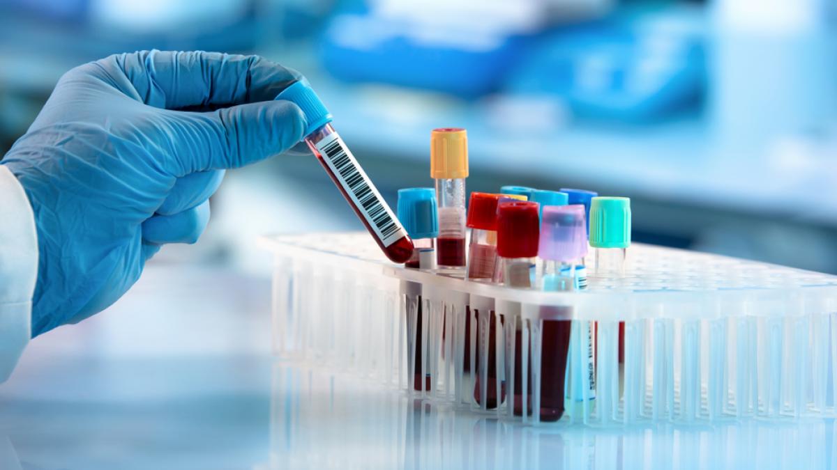 Vești BUNE pentru românii de peste  40 de ani. Lista analizelor medicale gratuite
