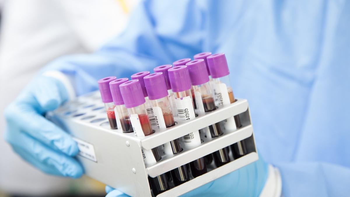 „Catastrofa globală” veche de 140 de ani. Tuberculoza: Un nou test rapid ar putea detecta milioane de transmițători silențioși