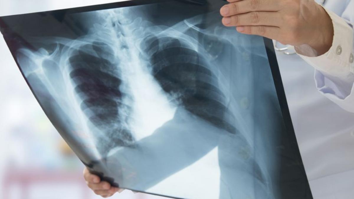 Infecţiile respiratorii, trend descrescător, în săptămâna 29 aprilie - 5 mai