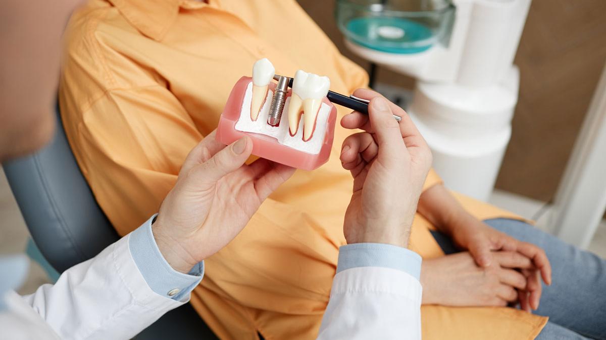 Garanția implantului dentar: Asumarea intervenției medicale