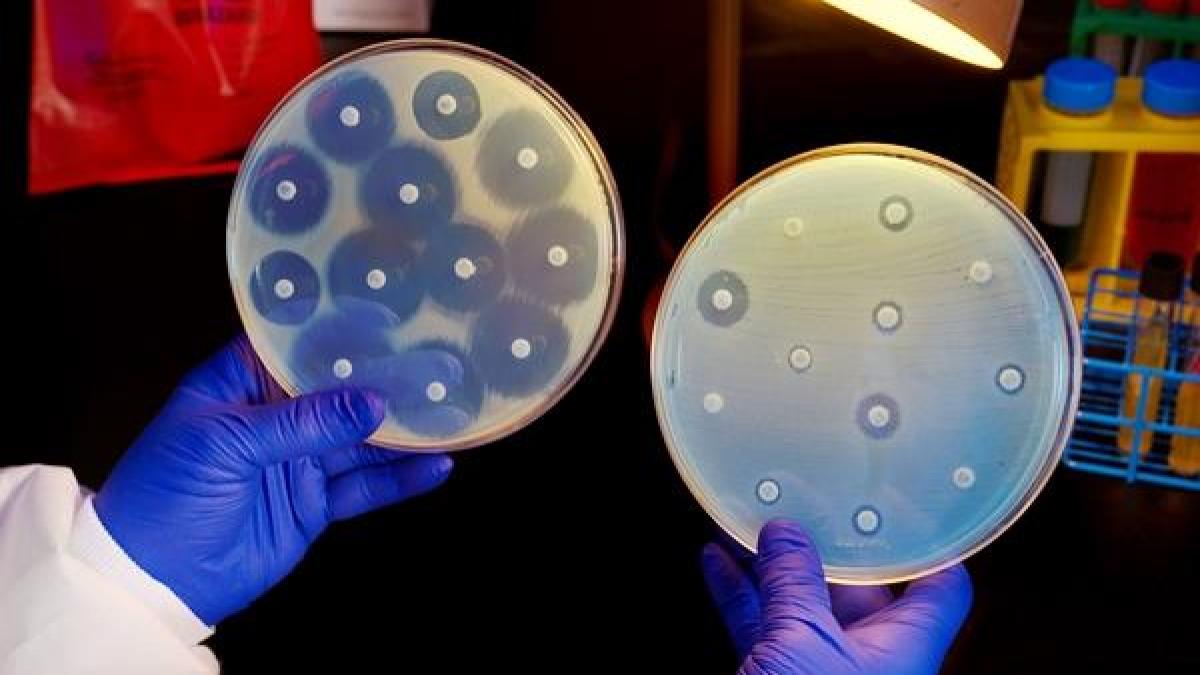 Un nou tip de antibiotic elimină riscul de apariție a superbacteriilor