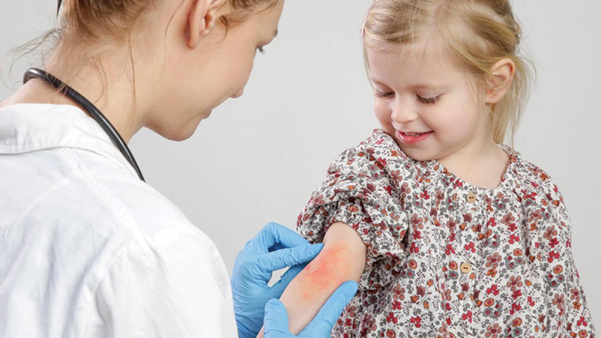 Cum sa faci fata provocarilor in viata de zi cu zi daca suferi de dermatita atopica