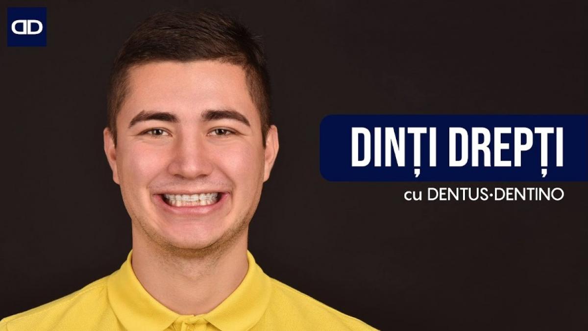 (P) Nu știi ce tip de aparat dentar ți se potrivește: invizibil, safir, metalic sau ceramic? La Dentus•Dentino, toate opțiunile sunt la îndemâna ta!