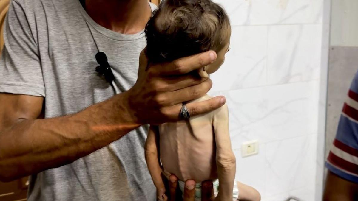 Foamete în Fâșia Gaza. Malnutriție severă la copii. Populația afectată de ordine de evacuare 
