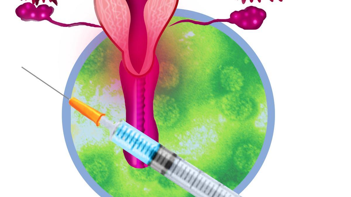 România rămâne țara cu cea mai mare mortalitate prin cancer de col uterin în UE: experți și decidenți cer acțiuni rapide pentru prevenție, vaccinare și screening