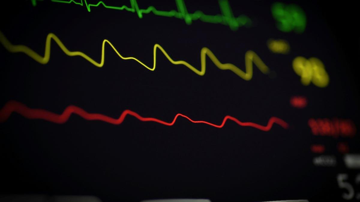 Un medic cardiolog dezvăluie ce să NU mănânci dacă vrei să eviți infarctul