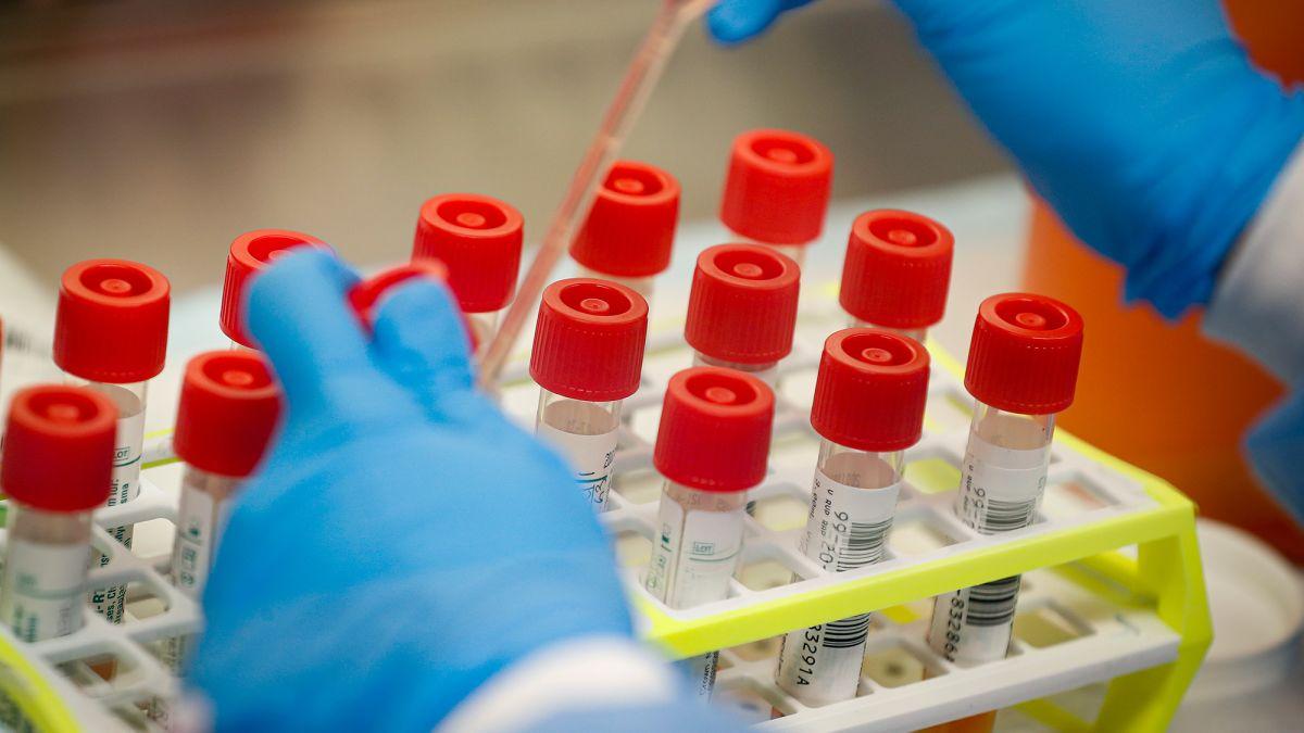 Descoperire medicală: Legătura dintre grupa sanguină și riscul de AVC
