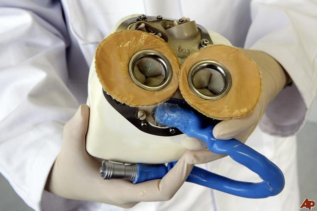 Inima artificială perfectă, în mâinile doctorilor francezi