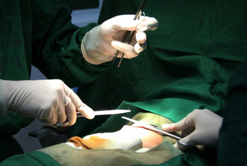 CHIRURGIA VIITORULUI / Laser în loc de aţă chirurgicală