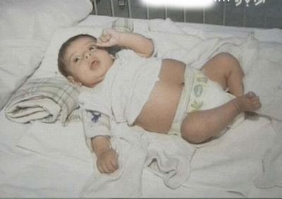 O fetiţă de un an din Arabia Saudită este însărcinată 
