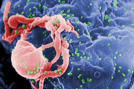 Vaccinul împotriva SIDA, tot mai aproape de realitate