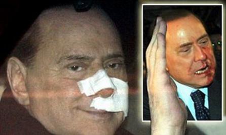 Un filmuleţ postat pe You Tube sugerează că Berlusconi şi-a înscenat atacul