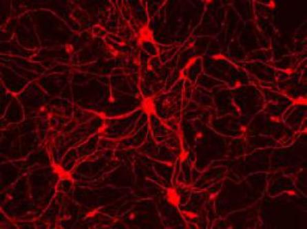 Celule din piele de şoarece pot fi transformate direct în neuroni funcţionali