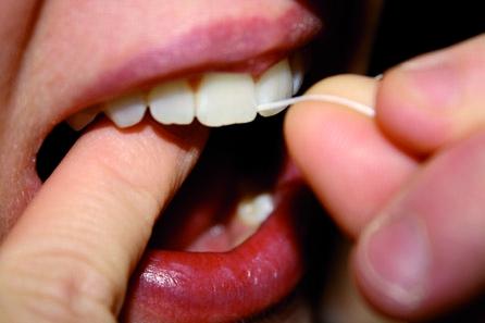 Aţa dentară - utilitate sau moft?