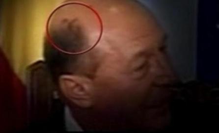 Preşedinţia, despre petele suspecte apărute pe capul lui Traian Băsescu: Nu sunt motive de îngrijorare 