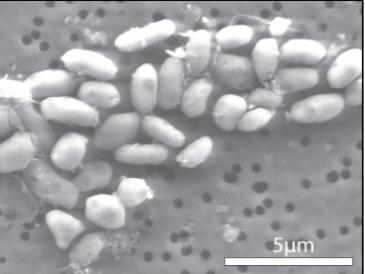 NASA a descoperit o bacterie care trăieşte în arsenic
