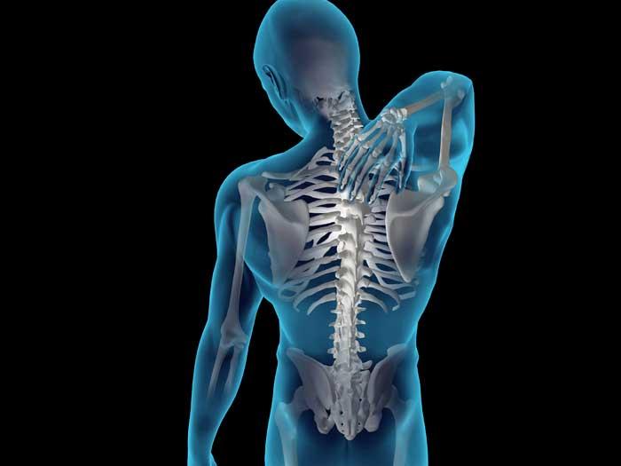 Radiografia invizibilă a coloanei vertebrale