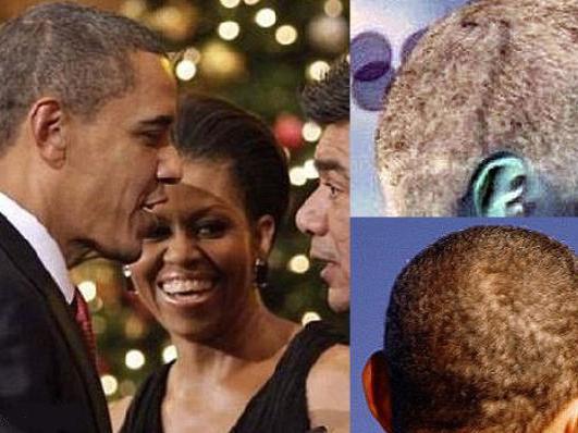 O cicatrice de pe scalpul lui Obama dă naştere la teorii ale conspiraţiei