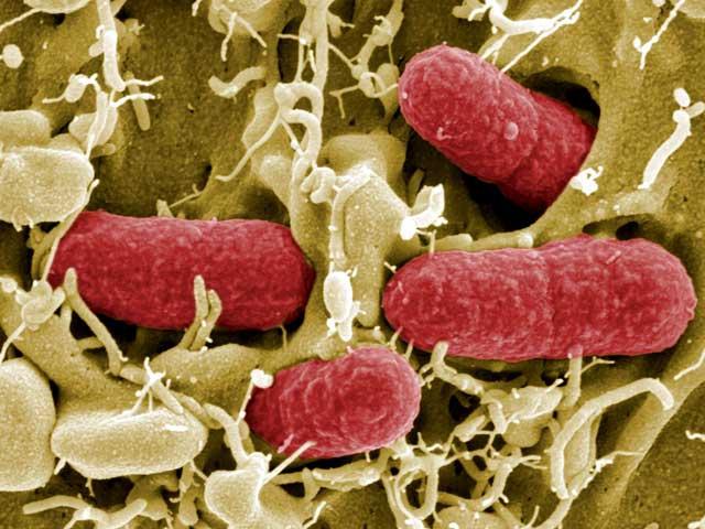 Bacteria care atacă Europa este necunoscută.