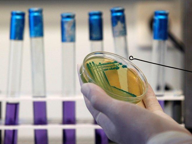 Bilanţul epidemiei de E.coli a ajuns la 35 de morţi.