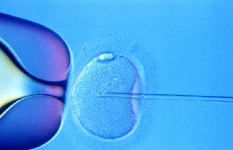 Suedezii au descoperit cum să reducă riscul de sarcină multiplă la fertilizarea in vitro