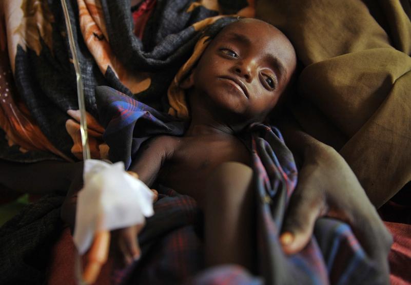 Imagini cutremurătoare din Somalia: 500.000 de copii în pragul morţii, din cauza foametei  (VIDEO)