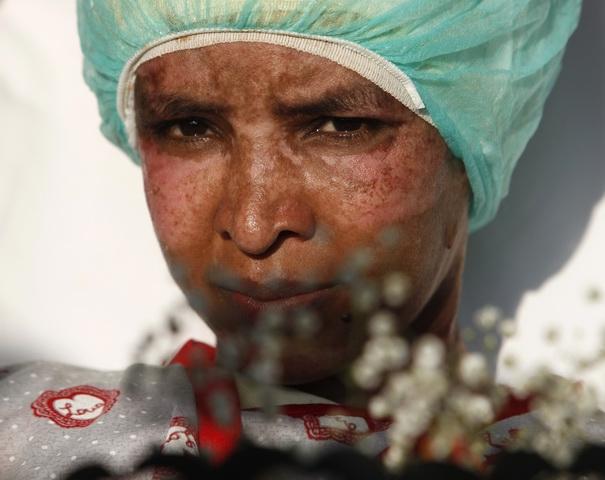 Bona mutilata a familiei Gaddafi va fi tratată în Malta. Galerie FOTO 1562392