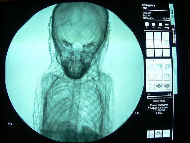 Misterul unei mumii, dezvăluit de o radiografie