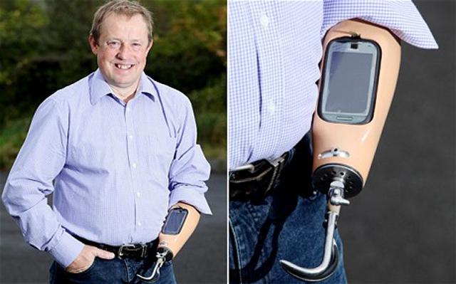 Omul cu telefon mobil în proteza care îi ţine loc de mână