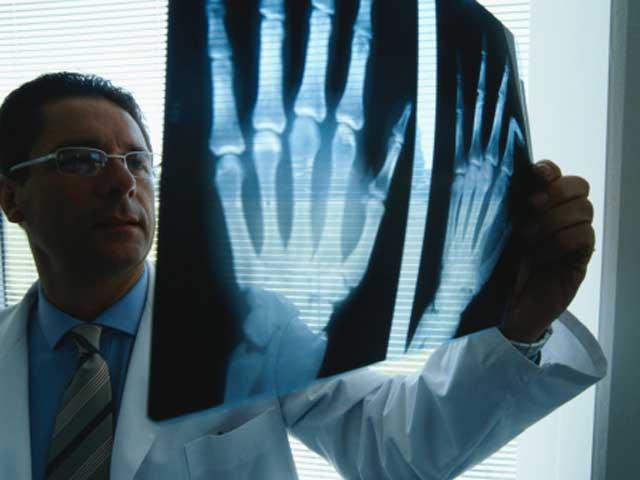 Avertisment: Osteoporoza nu doare, dar te aboneaza la ortopedie