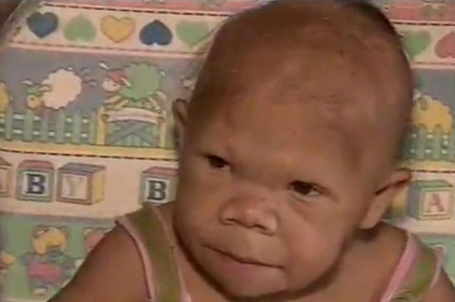 Caz medical incredibil: Are 30 de ani, dar seamănă cu un bebeluş! (VIDEO)