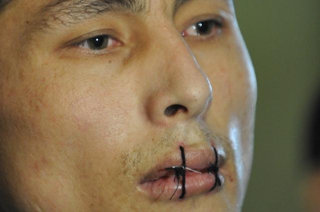 Kîrgîzstan: Peste 1.300 de deţinuţi şi-au cusut buzele şi aproape 7.000 sunt în greva foamei