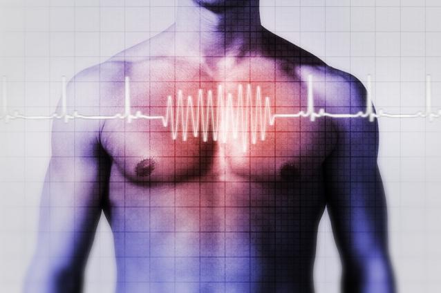 Fundaţia Română a Inimii: La fiecare jumătate de oră, un român face infarct miocardic acut