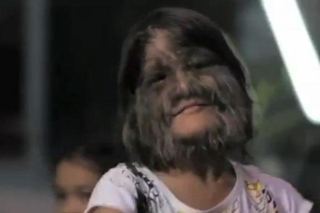 VIDEO: Cum trăieşte şi cum este tratată de comunitate cea mai păroasă fată din lume