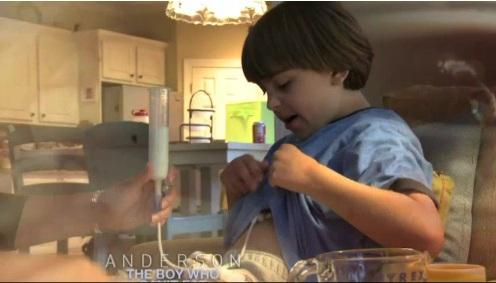 Băieţelul de 9 ani alergic la mâncare (VIDEO)