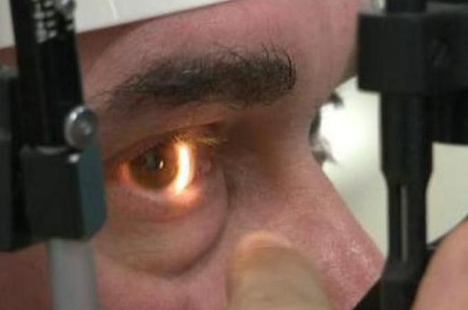 Premieră medicală: După 20 de ani de întuneric, un bărbat din Marea Britanie care a primit "ochiul bionic" vede din nou (VIDEO)