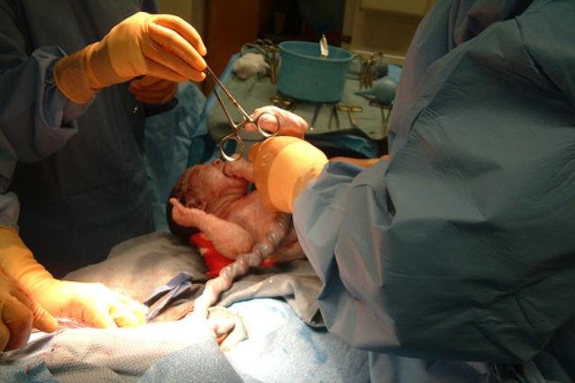 Culmea austerităţii: un bebeluş ţinut "ostatic" într-o maternitate din Atena până la plata operaţiei prin cezariană