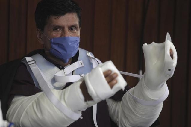 Premieră medicală în America Latină: Un bărbat a beneficiat de dublu transplant de braţe