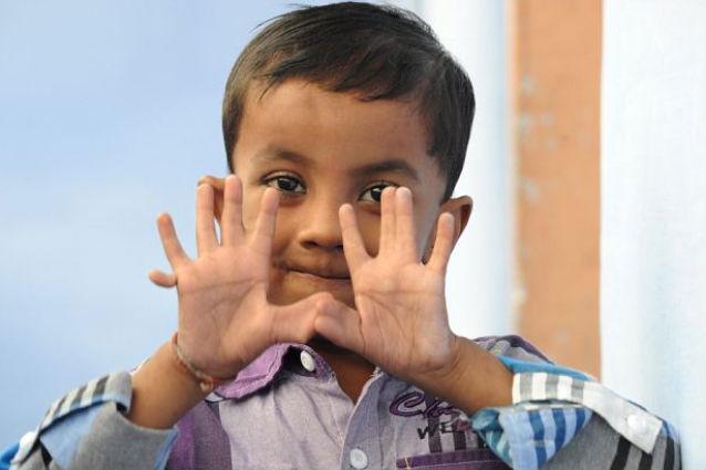 Copilul cu 25 de degete! Trăieşte în India iar părinţii nu doresc să-l opereze pentru a rămâne celebru