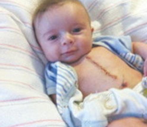 A strâns peste 1 MILION de vizualizări: El este bebeluşul operat pe cord deschis &quot;care arată ridicol de bine&quot;