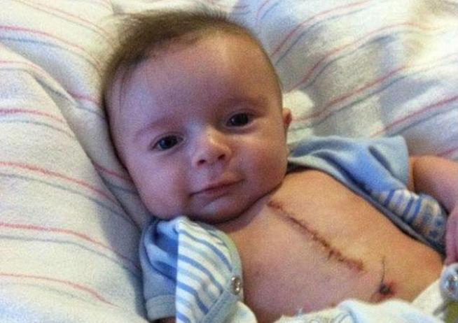 VIDEO: Bebeluşul operat care arată ridicol de bine - peste un milion de like-uri pe Facebook şi milioane de comentarii